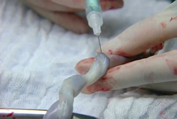 ذخیرهی ۸۲ مورد خون بندناف از آغاز امسال ذخیرهی ۸۲ مورد خون بندناف از آغاز امسال